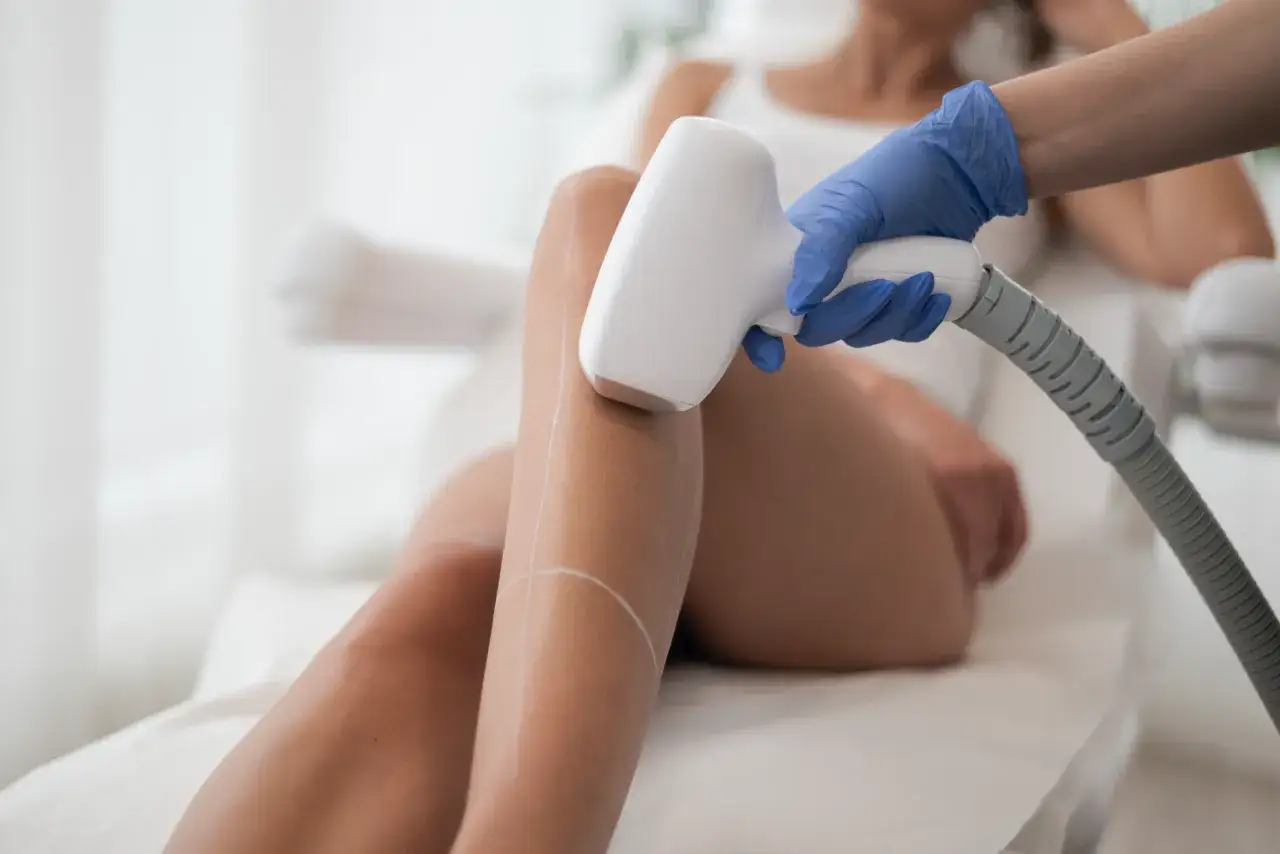 Depilacja laserowa a antybiotyk – zabieg na nogę z zaznaczonymi liniami. Dłoń w rękawiczce trzyma głowicę lasera.
