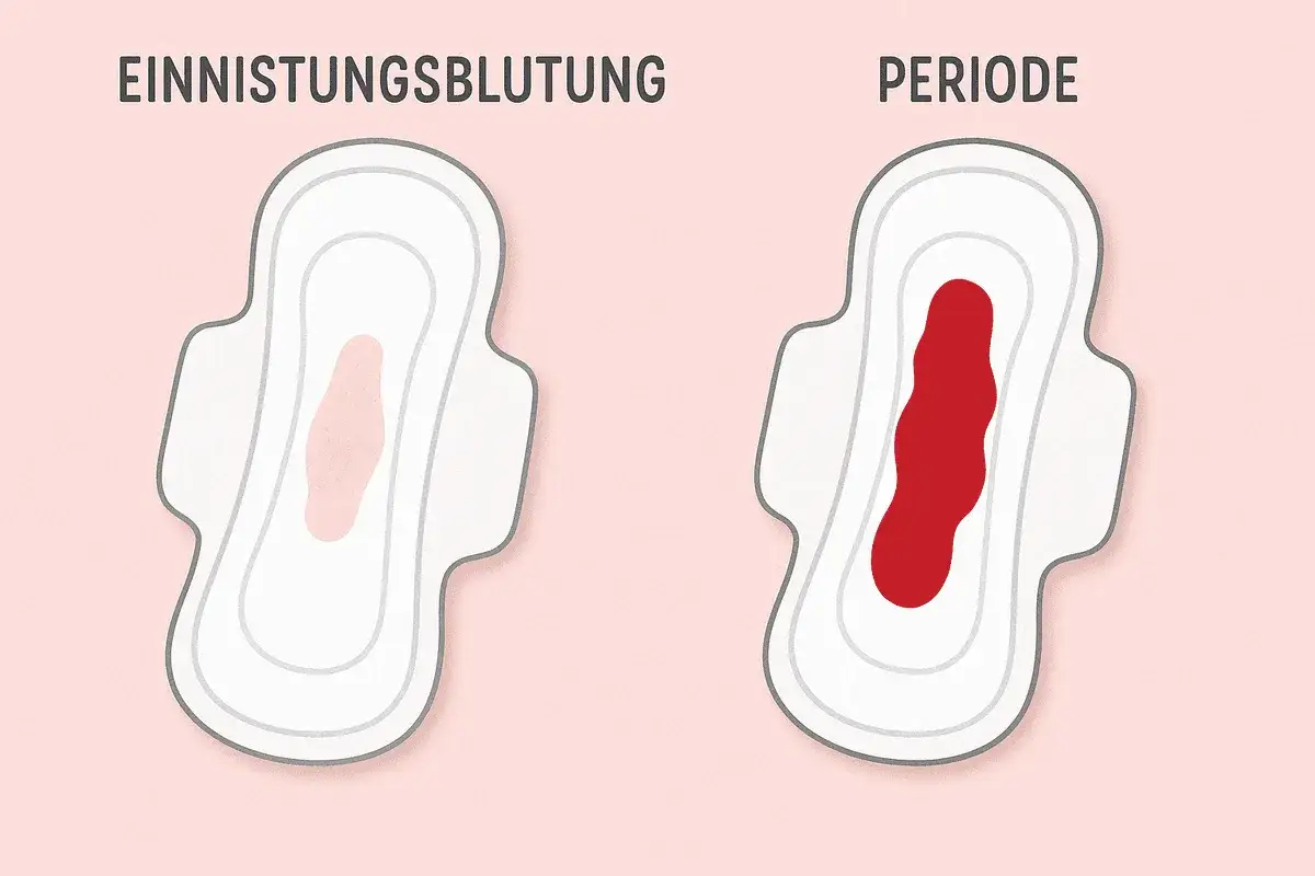 Zwei Binden: links leichte rosa Blutung (Einnistungsblutung), rechts starke rote Blutung (Periode). Schwanger trotz Periode? Hier der Unterschied.