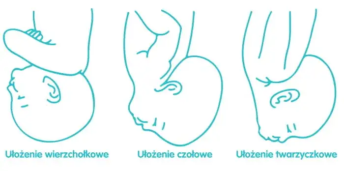 Zdjęcie Kiedy dziecko obraca się główką w dół? Sprawdź, co musisz wiedzieć