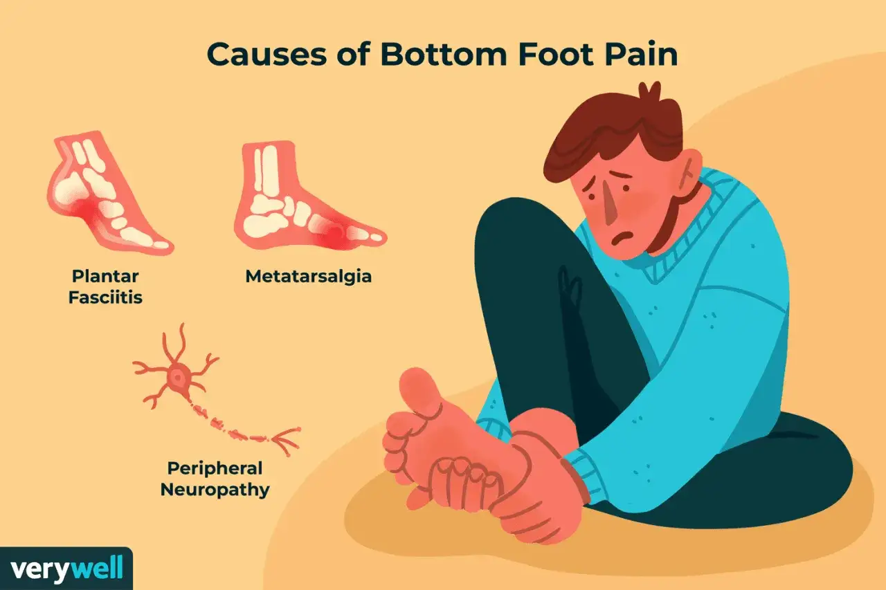 Uomo seduto con espressione sofferente, che si tiene il piede. Illustrazione mostra cause di dolore sotto pianta del piede al centro: fascite plantare, metatarsalgia, neuropatia periferica.