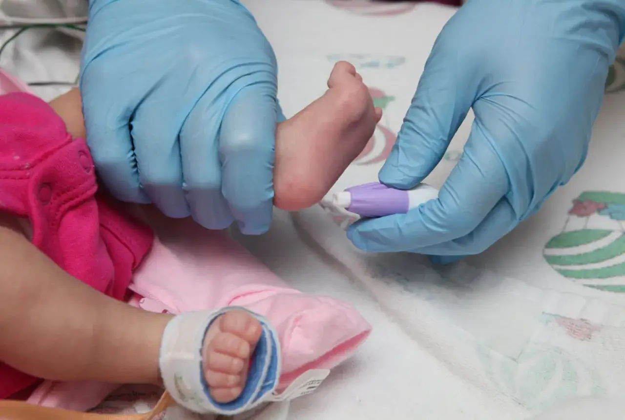 Mani guantate eseguono una puntura sul tallone di un neonato per la chiamata per secondo screening neonatale.