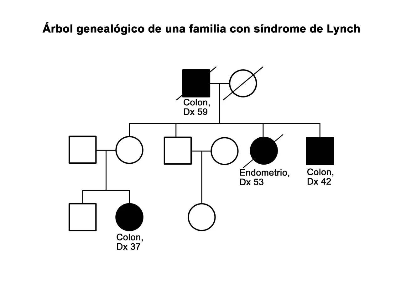 Ejemplos de &aacute;rbol geneal&oacute;gico que muestra la herencia del s&iacute;ndrome de Lynch, con afectados por c&aacute;ncer de colon y endometrio.