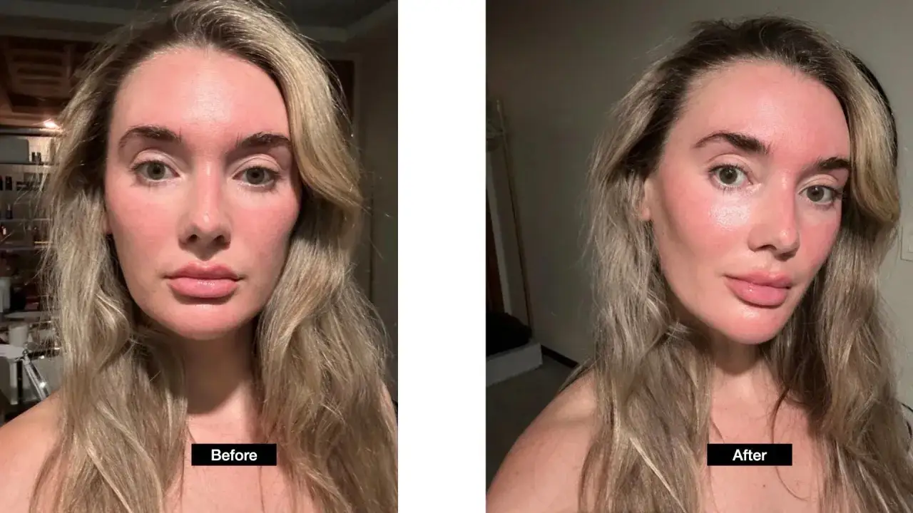 Confronto massaggio viso prima e dopo: la pelle appare pi&ugrave; luminosa e rimpolpata dopo il trattamento.
