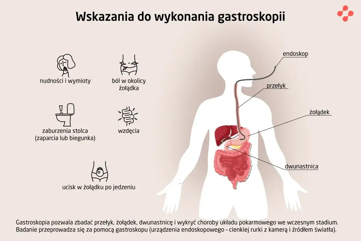Grafika pokazuje wskazania do gastroskopii: nudności, ból brzucha, wzdęcia, problemy z wypróżnianiem. Badanie trwa krótko.