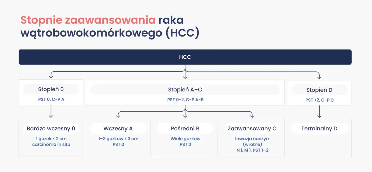 Schemat przedstawia, ile jest stadium raka wątrobowokom&oacute;rkowego (HCC), od bardzo wczesnego do terminalnego, z podziałem na stopnie zaawansowania.