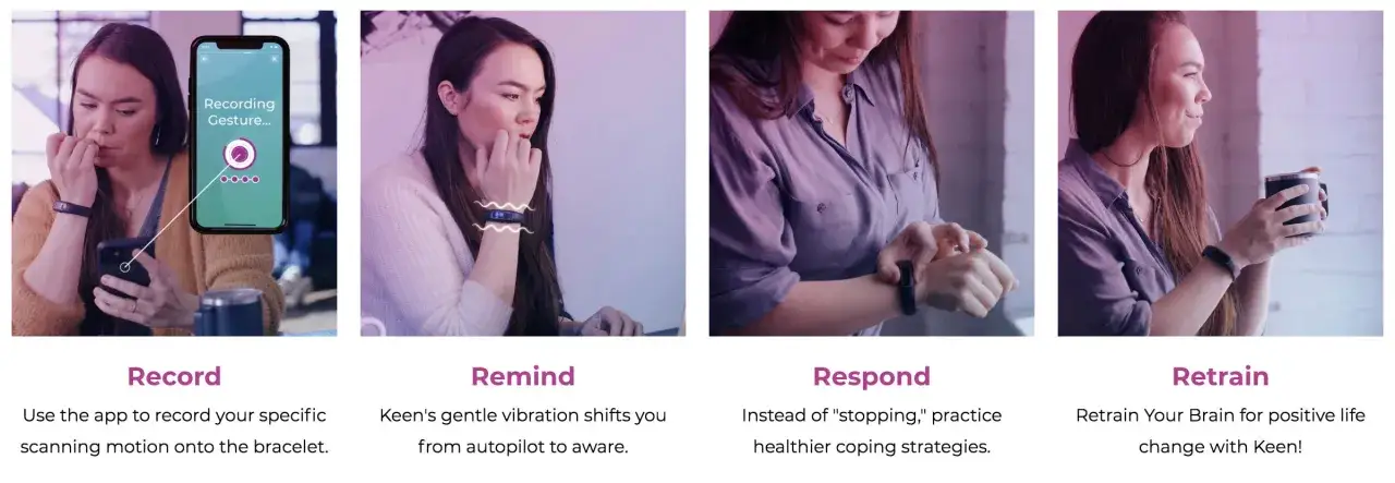 La donna usa un'app e un braccialetto per gestire la dermatillomania, imparando a smettere con strategie pi&ugrave; sane.