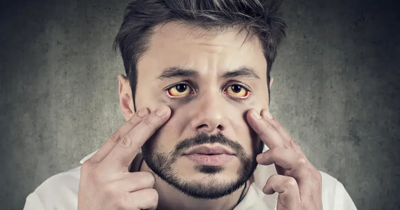 Zespół Gilberta objawy psychiczne grafika