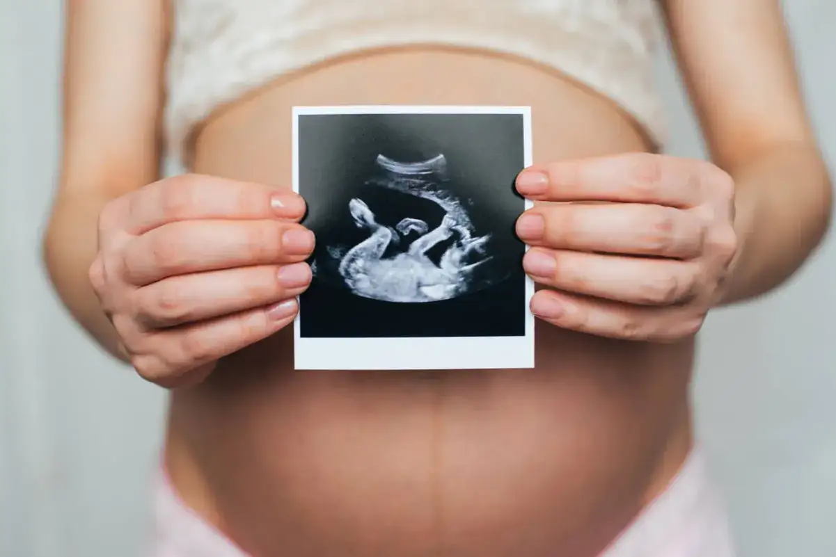 Ciężarna kobieta trzyma zdjęcie USG, na którym widać dziecko. Widać też jej brzuch i łożysko na przedniej ścianie.