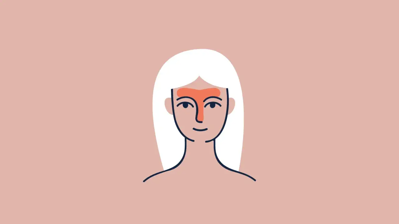 Ilustración de una cara con la zona T resaltada en naranja, indicando la producción de sebo.
