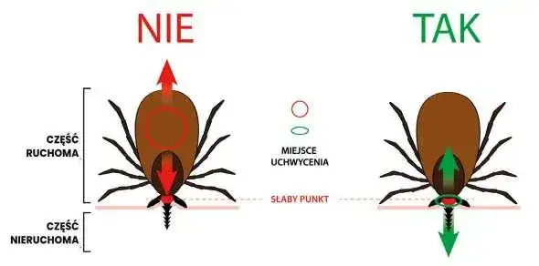 jak usunąć gł&oacute;wkę kleszcza pęsetą