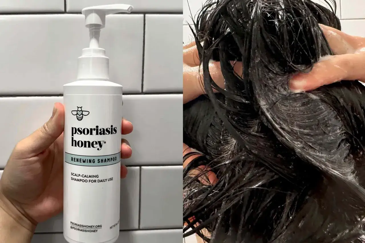Szampon Psoriasis Honey w białej butelce z pompką, obok mokrych, ciemnych włosów masowanych dłonią z pianą. Pomaga na łupież i suchą skórę głowy.