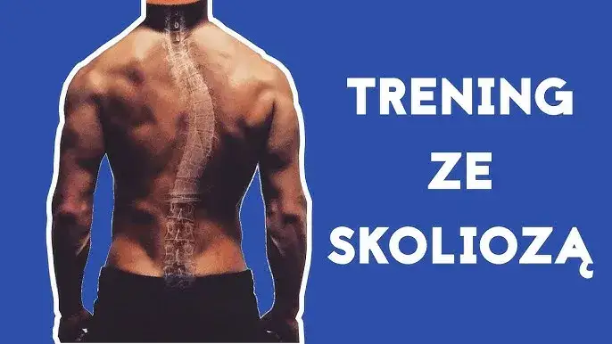 Bezpieczne ćwiczenia na siłowni przy skoliozie