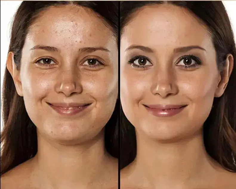 efekt glow na skórze przed i po serum