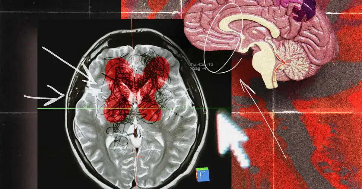 m&oacute;zg fMRI religia medytacja aktywacja