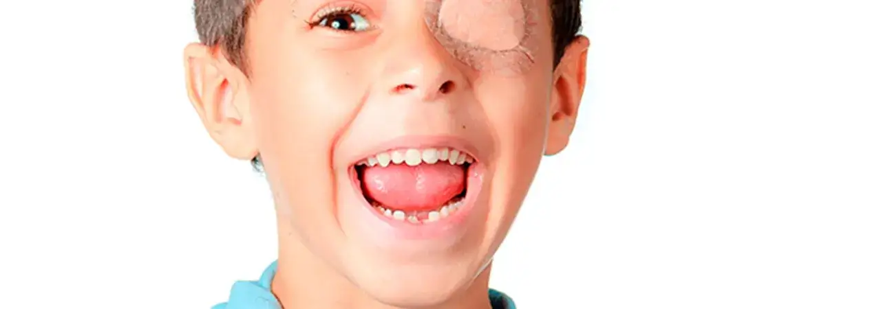 Ni&ntilde;o sonriente con parche en el ojo, tratando de corregir su ojo vago.