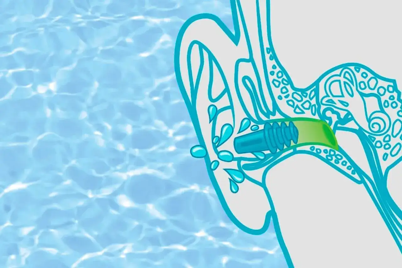 Illustration zeigt ein Kind, dem Wasser ins Ohr läuft. Ein Ohrstöpsel schützt vor dem Wasser im Ohr.