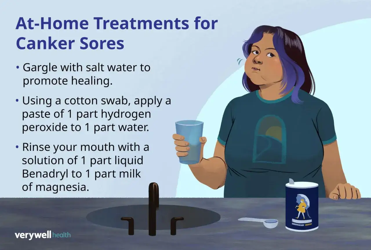 Hausmittel gegen wunden im Mund: Salzwasser gurgeln, Wasserstoffperoxid-Paste oder Mundsp&uuml;lung mit Benadryl und Magnesia.