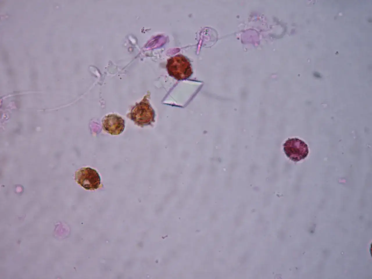 leukocyty pod mikroskopem