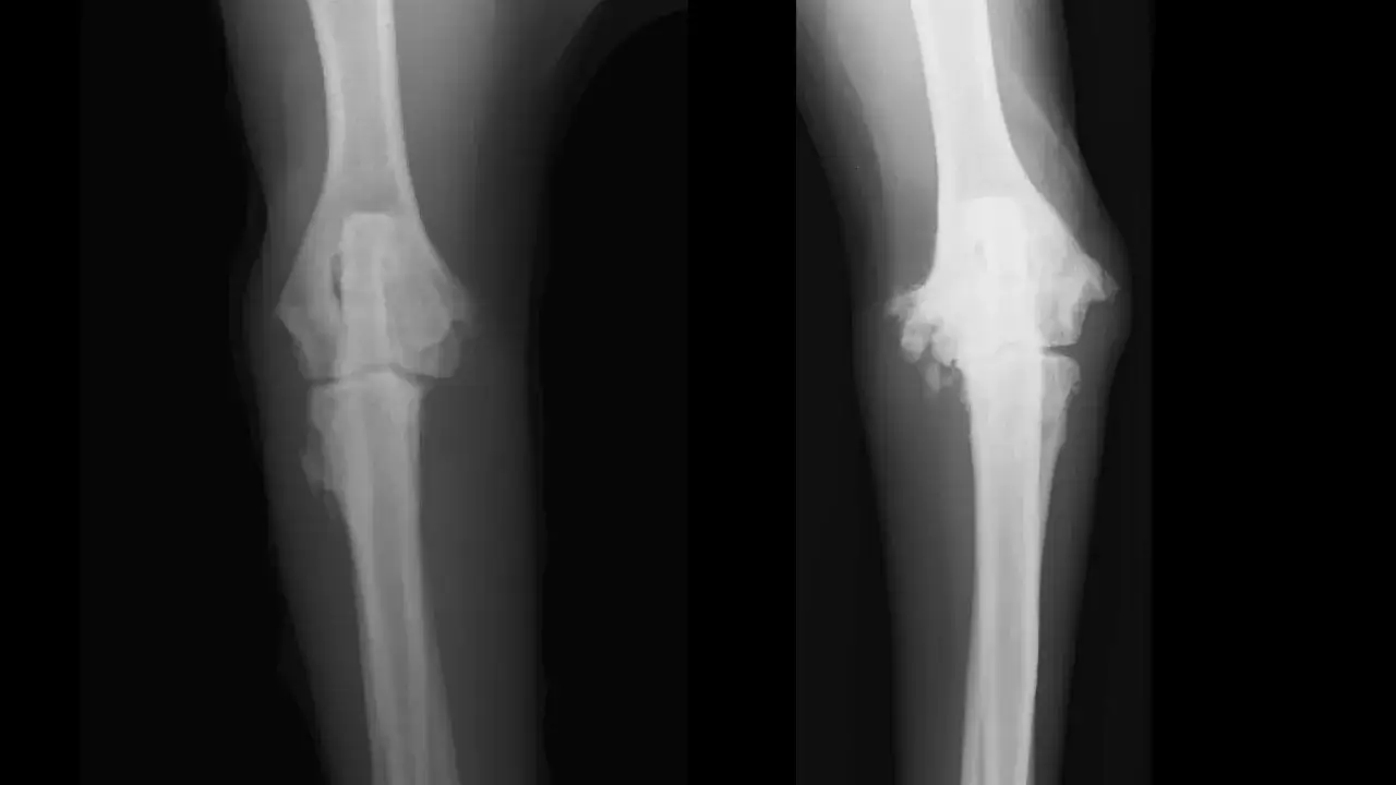 Radiografías de codos caninos mostrando displasia de codo, con irregularidades óseas y signos de artrosis.