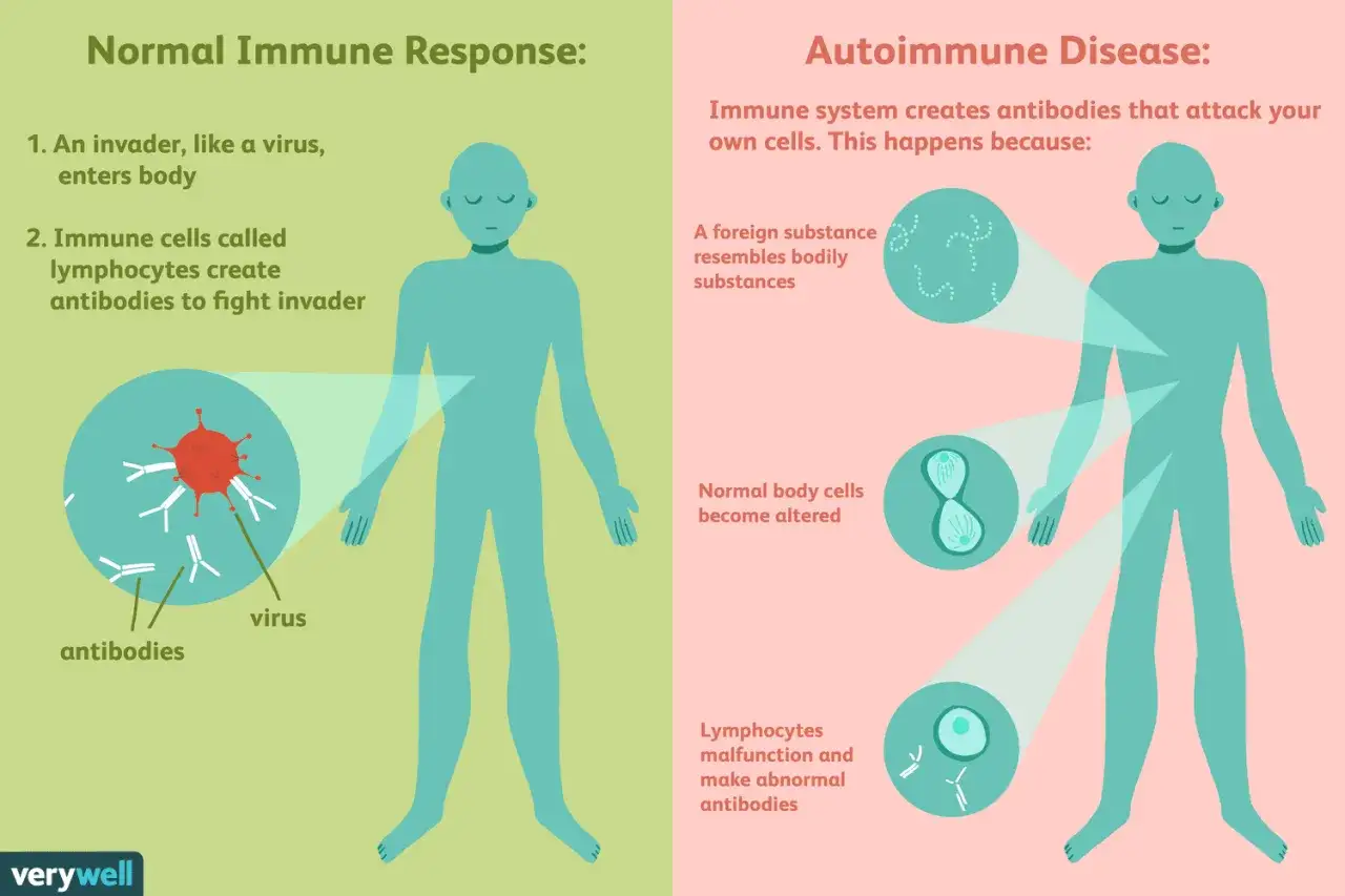 Spiegazione del significato di autoimmune: il sistema immunitario attacca le cellule del corpo, a differenza della risposta normale contro i virus.