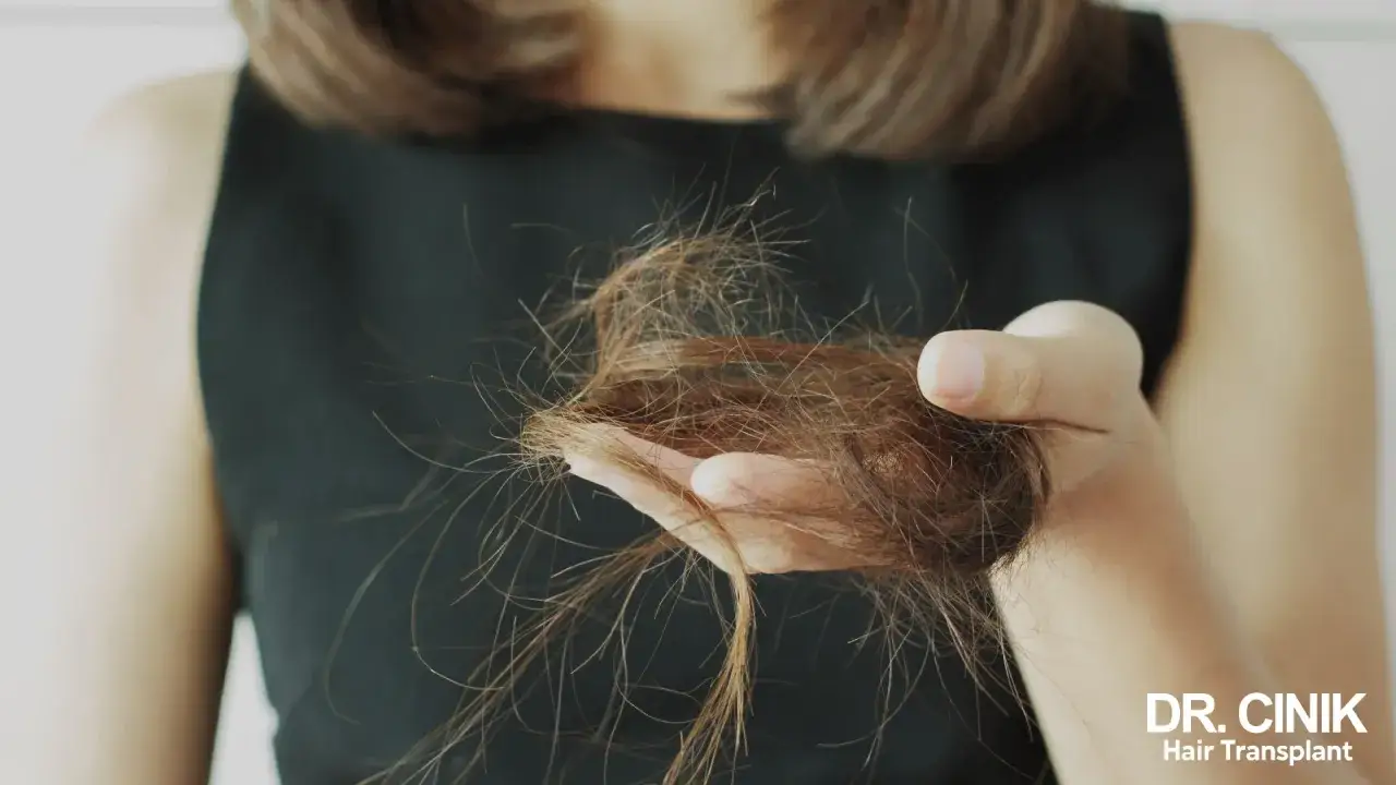 Main d'une femme tenant une touffe de cheveux. Une femme de 40 ans peut &ecirc;tre concern&eacute;e par la perte de cheveux.