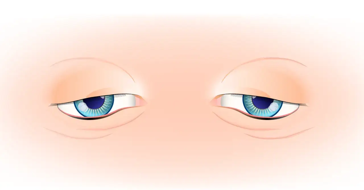 Two blue eyes with heavy lids, looking sideways. It's like sleeping with eyes open, a state of weary observation.