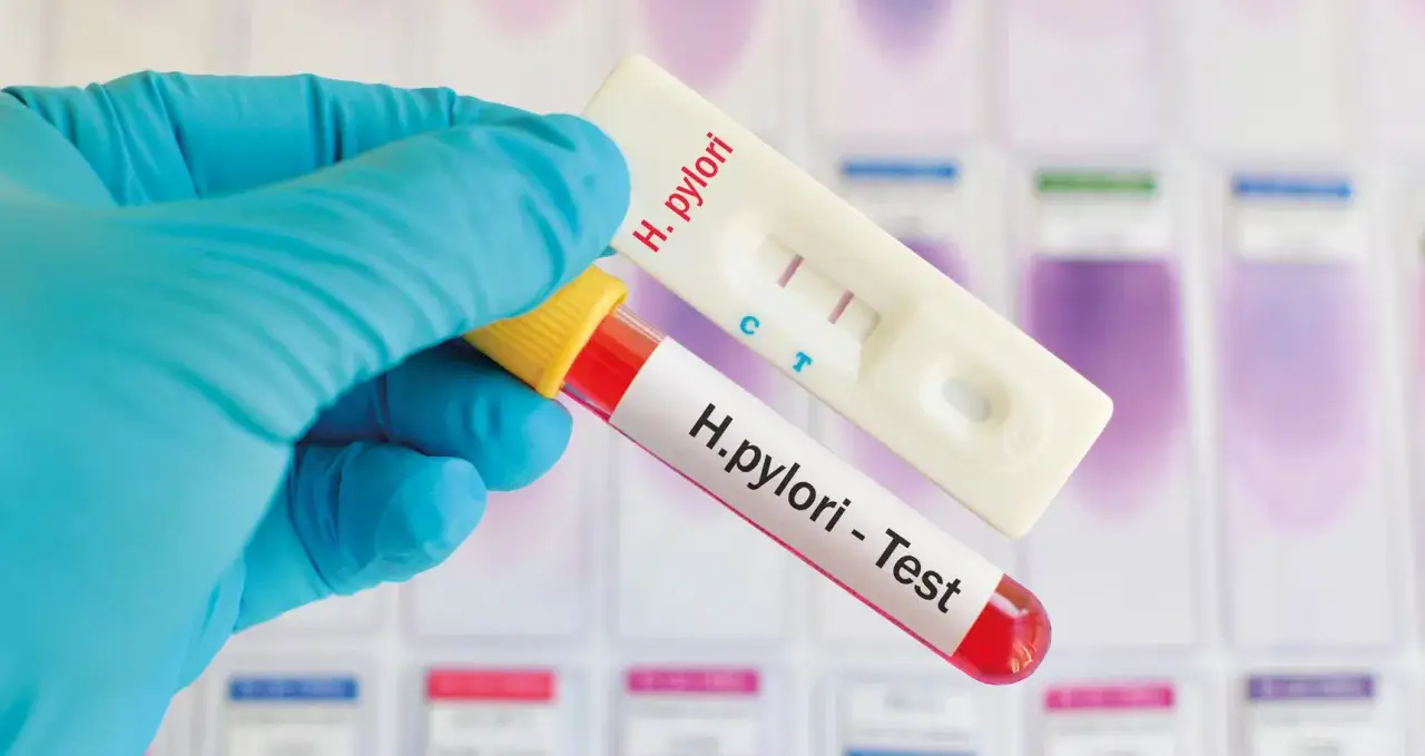 Rękawiczka trzyma probówkę z krwią i test kasetkowy. Wynik testu ureazowego jest dodatni, co wskazuje na obecność bakterii H. pylori.