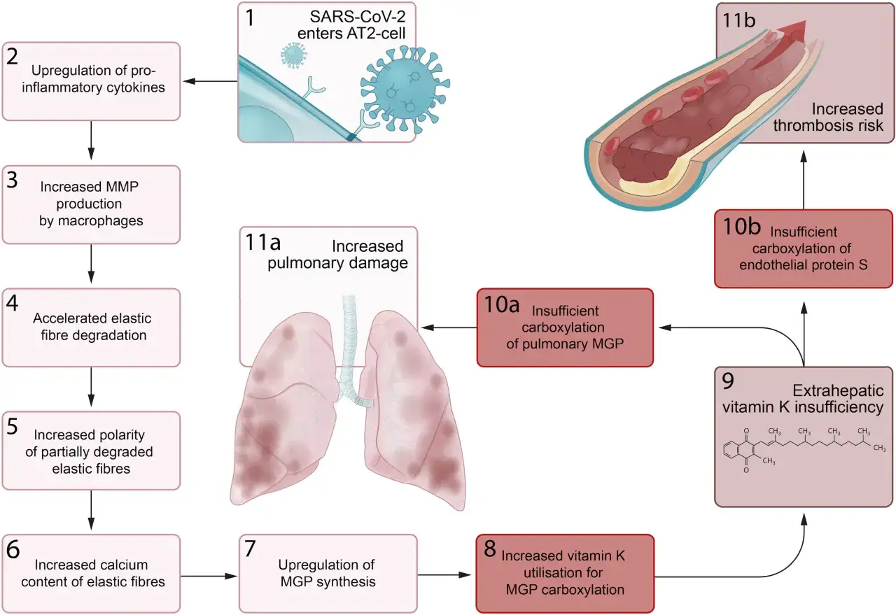 Schema zeigt, wie SARS-CoV-2 zu Lungen- und Gef&auml;&szlig;sch&auml;den f&uuml;hrt. Vitamin K2 ist wichtig f&uuml;r die Blutgerinnung.