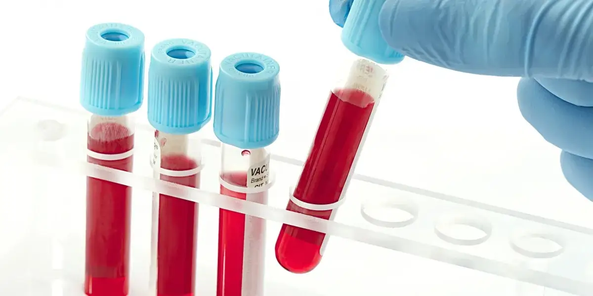 specjalistyczne badania laboratoryjne