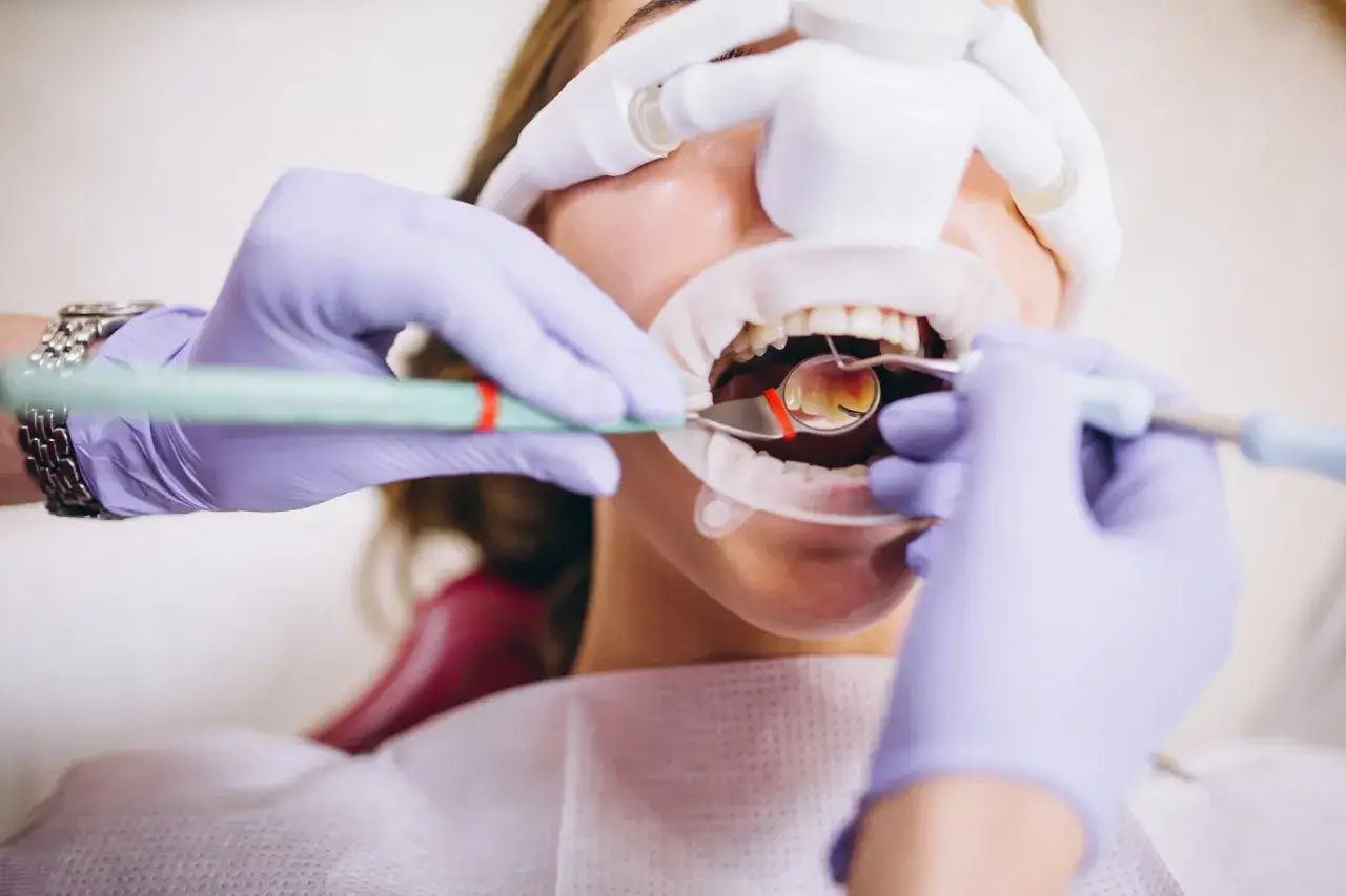 Uśmiechnięta pacjentka u dentysty. Widać jej zęby, rozwierak i narzędzia stomatologiczne. To wizyta u **fleczer**a, który dba o zdrowie jamy ustnej.