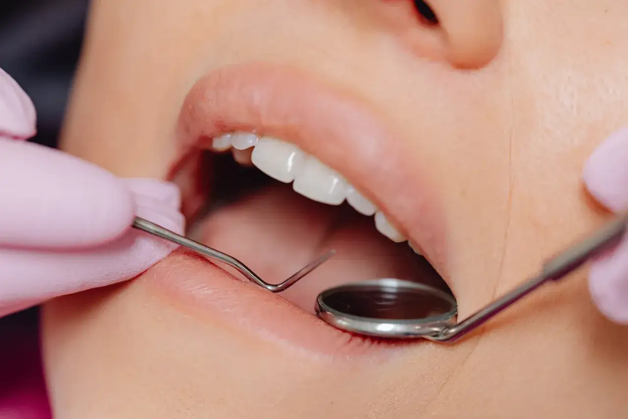 Usta pacjentki z widocznymi zębami, badane przez dentystę. Może to być związane z problemem nadwrażliwości zębów.