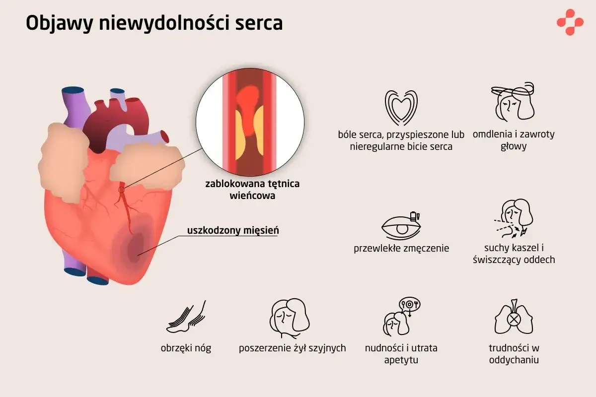 Objawy niewydolności serca: ból w klatce, omdlenia, zmęczenie, obrzęki, nudności, trudności z oddychaniem, a także suchy kaszel i świszczący oddech, który może być sygnałem, że to kaszel od serca.