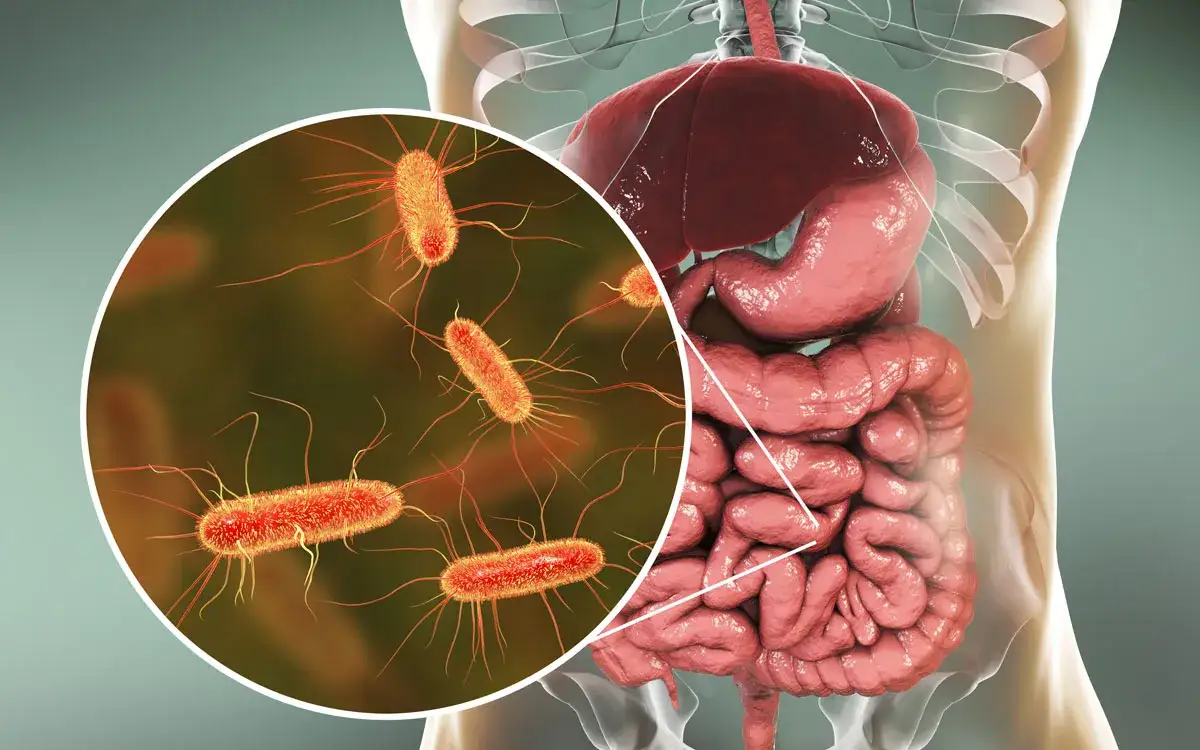Zdjęcie Symptome E. coli: Erkennen Sie die gef&auml;hrlichen Anzeichen einer Infektion