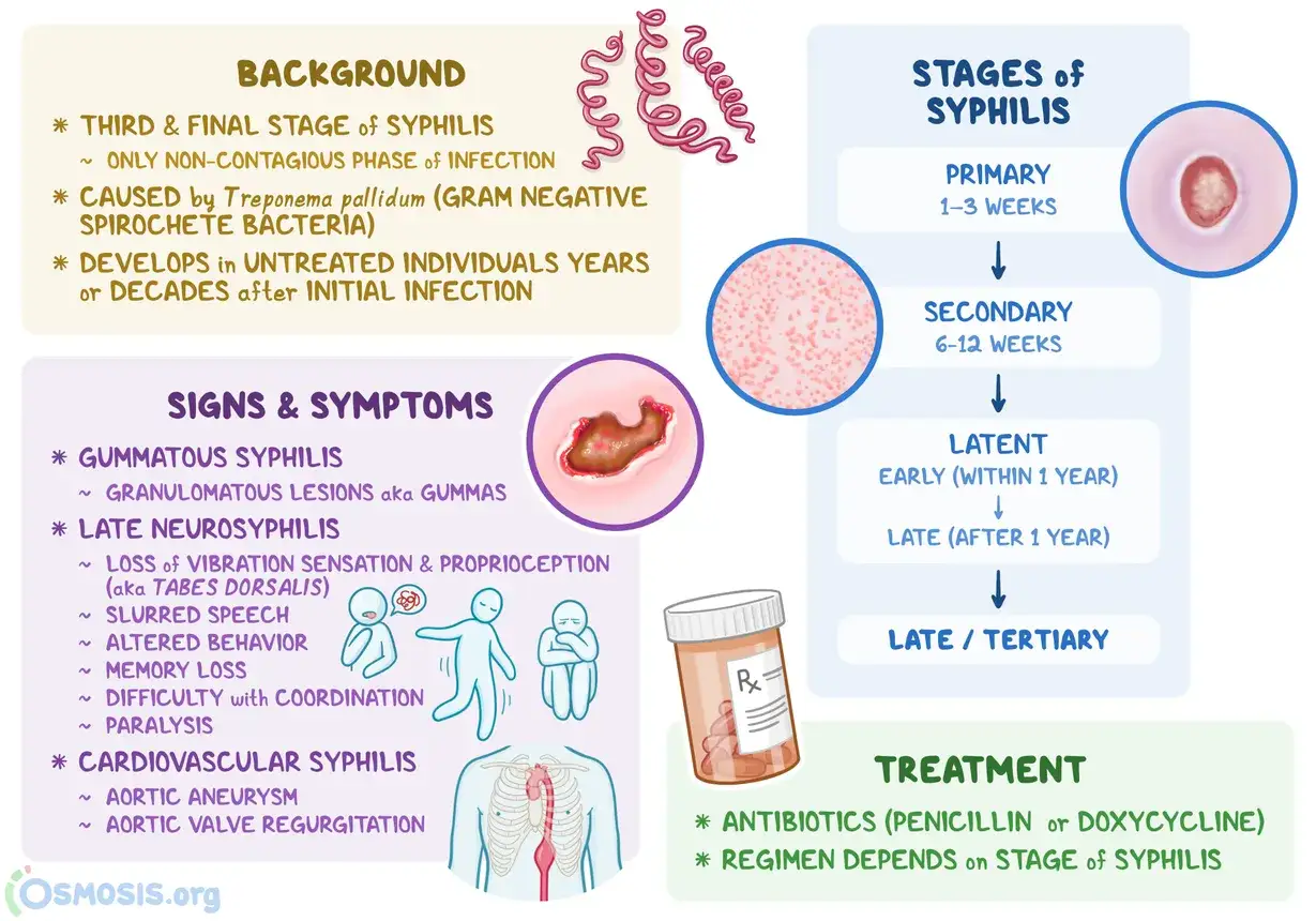 Infograf&iacute;a sobre la s&iacute;filis en mujeres, detallando etapas, s&iacute;ntomas como lesiones y neuros&iacute;filis, y tratamiento con antibi&oacute;ticos.
