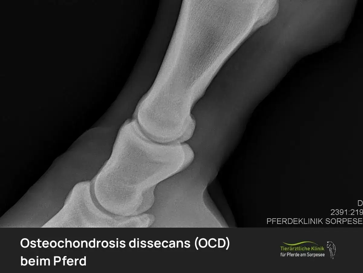 Röntgenbild eines Pferdefußes mit OCD (Osteochondrosis dissecans). Die Aufnahme zeigt die Knochenstruktur des Gelenks.