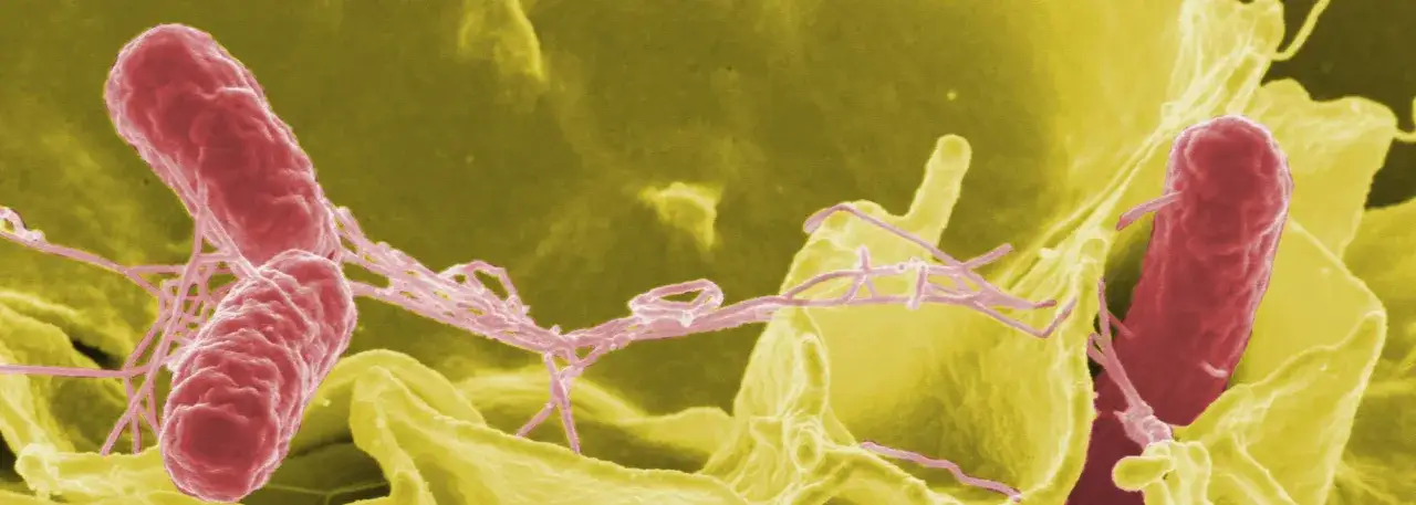 Bakterie Salmonella Typhi, wywołujące tyfus, z charakterystycznymi wiciami.
