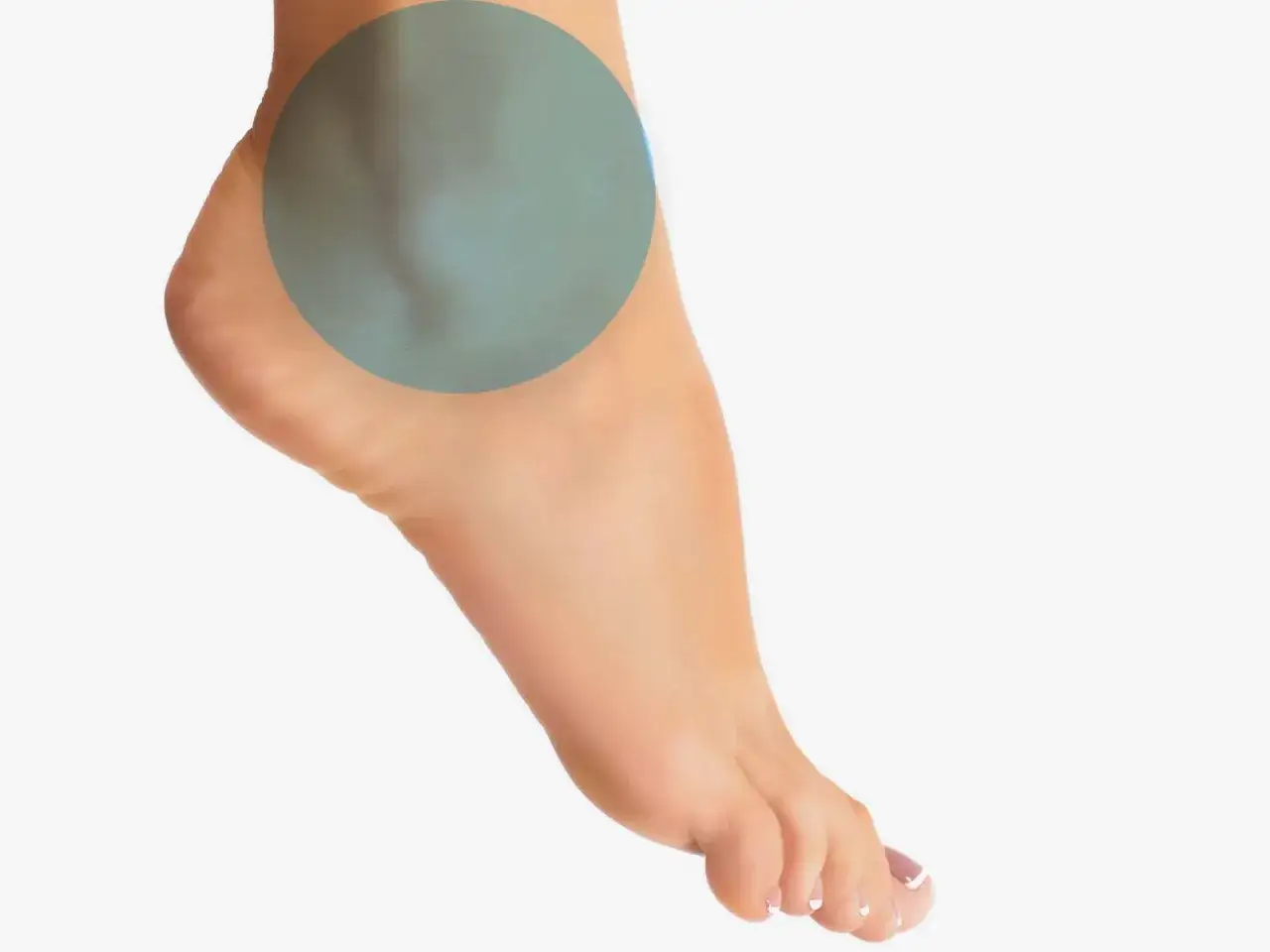 Piede di bambino con cerchio verde sull'osso sporgente esterno, indicando un possibile problema.