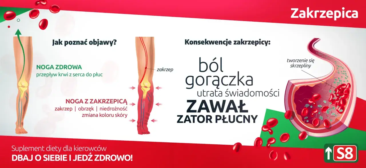 Infografika czynniki ryzyka zakrzepicy