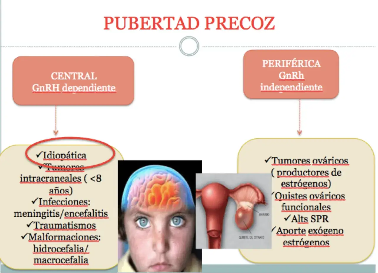 Diagrama sobre pubertad precoz en ni&ntilde;a de 7 a&ntilde;os, mostrando causas centrales y perif&eacute;ricas, con im&aacute;genes de cerebro y &uacute;tero.