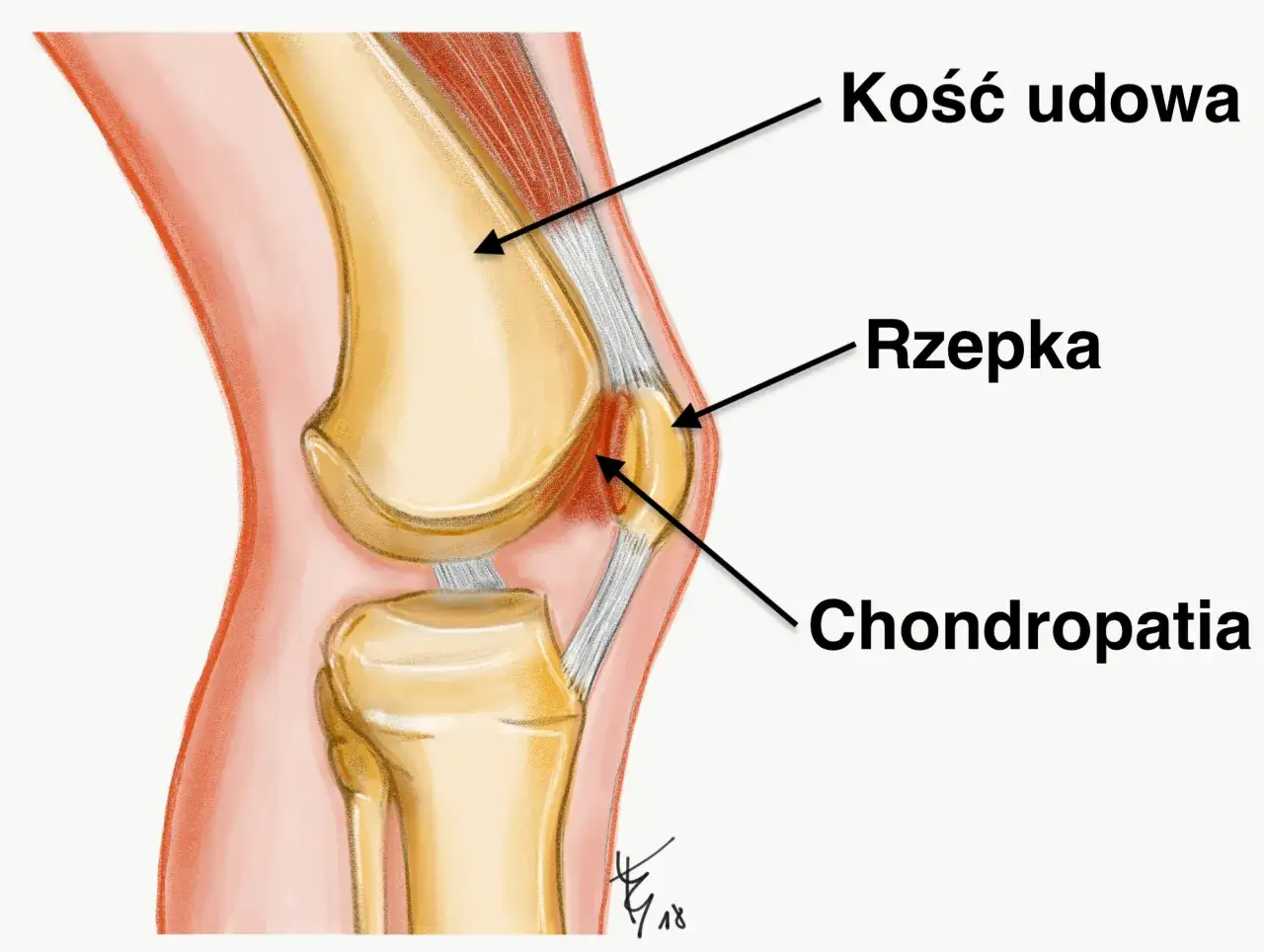 Anatomia kolana z opisem więzadeł, łąkotek i rzepki