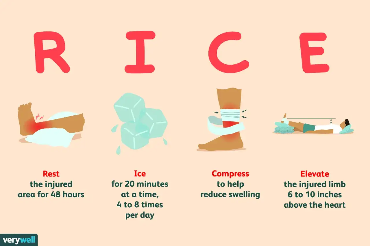 I RICE, rimedi per infortuni: Riposo, Ghiaccio, Compressione, Elevazione. Aiuta a ridurre gonfiore e dolore.