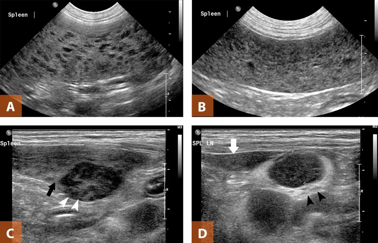 Ultraschallbilder eines Hundes mit Milztumor. Bild A zeigt eine Milz mit vielen hypoechogenen Läsionen. Bild C zeigt eine Milz mit einem großen, unregelmäßigen Tumor. Bild D zeigt vergrößerte Lymphknoten.