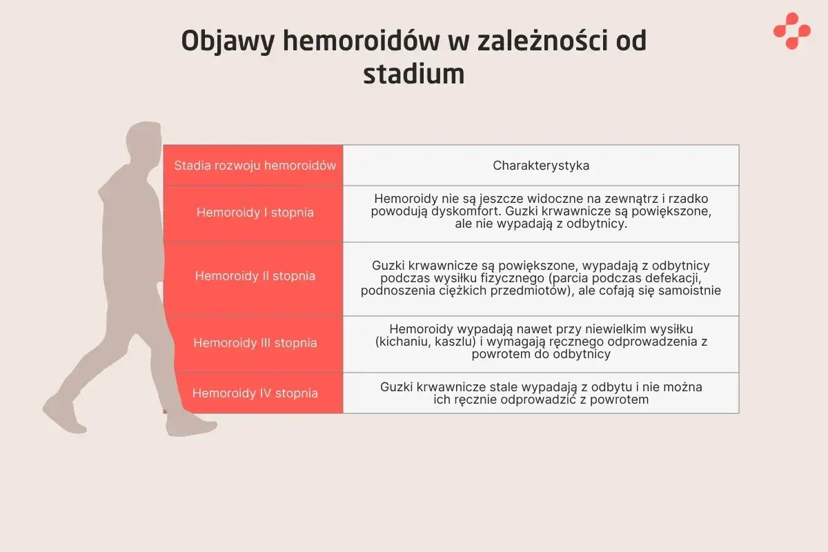 Tabela opisuje objawy hemoroidów zewnętrznych w zależności od stadium. Od I do IV stopnia, od niewidocznych do stale wypadających.