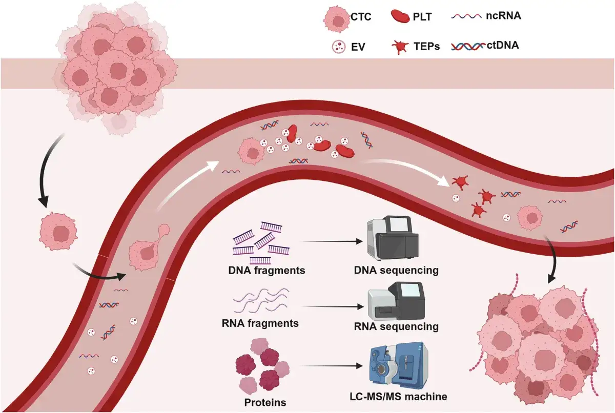 Darstellung einer **liquid biopsy**: Tumorzellen und DNA-Fragmente im Blutkreislauf werden analysiert.