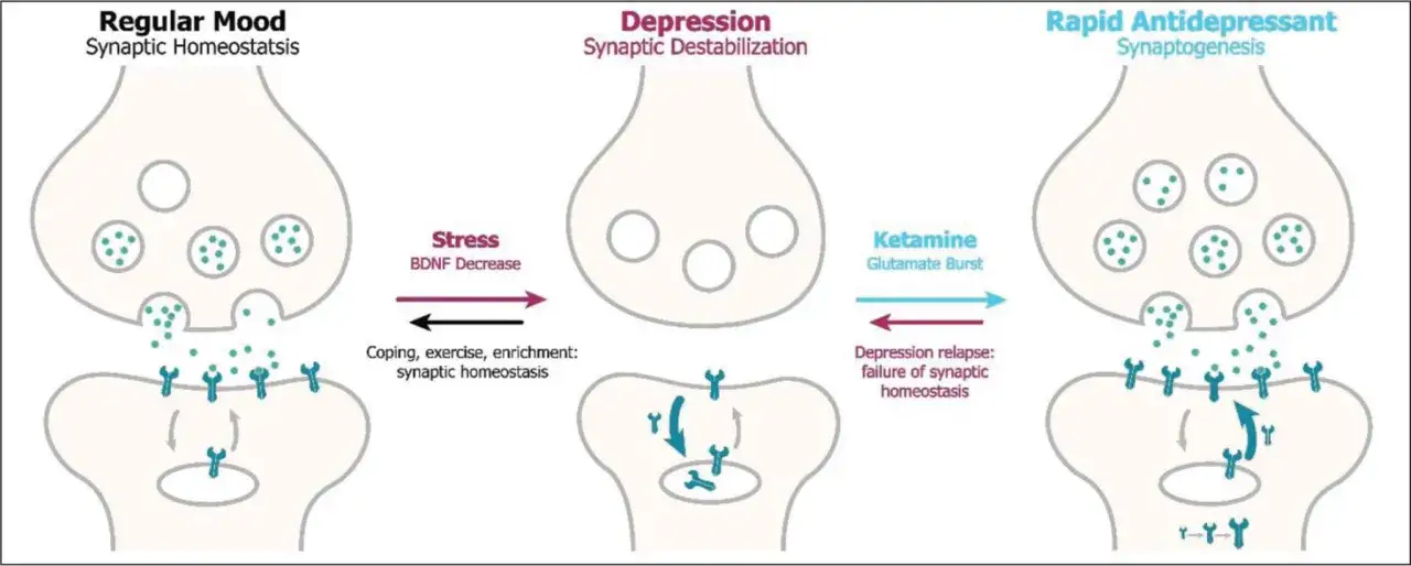 Schema che illustra i **ketamina effetti positivi** sul cervello, contrastando la depressione con un aumento del glutammato e la sinaptogenesi.