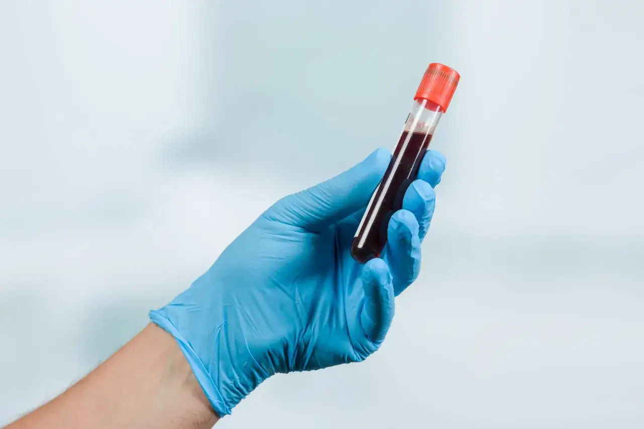 Ręka w niebieskiej rękawiczce trzyma probówkę z krwią. To próbka do badania psa, które pomoże zdiagnozować jego chorobę.