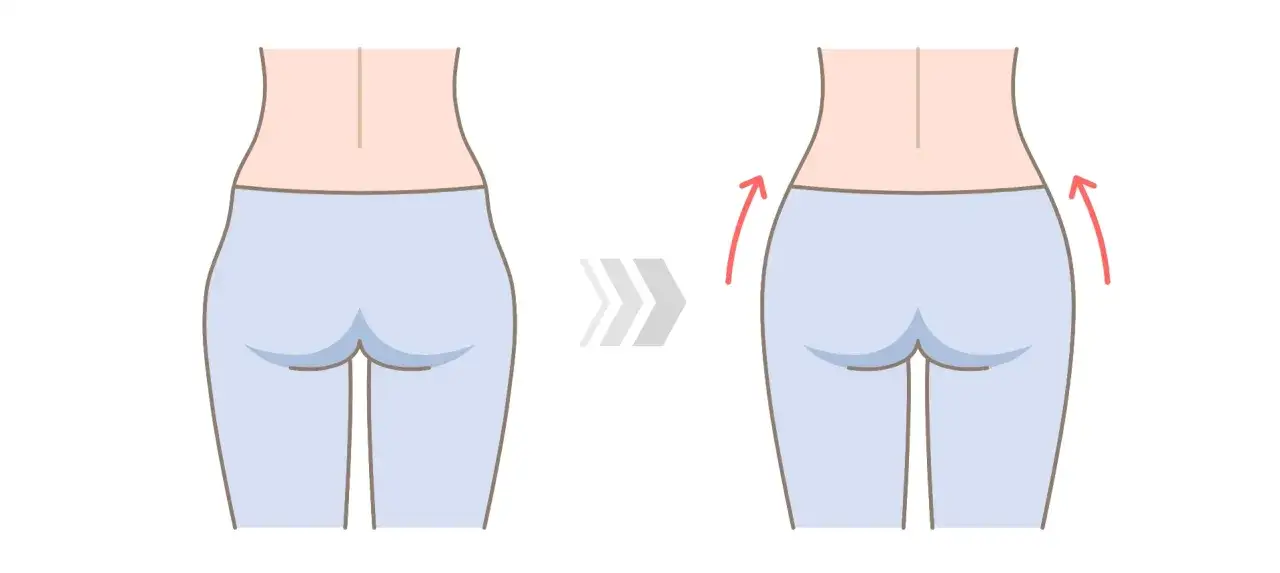Ilustracja pokazuje, jak ćwiczenia mogą pomóc zredukować tzw. hip dips, czyli wgłębienia po bokach bioder, modelując sylwetkę.