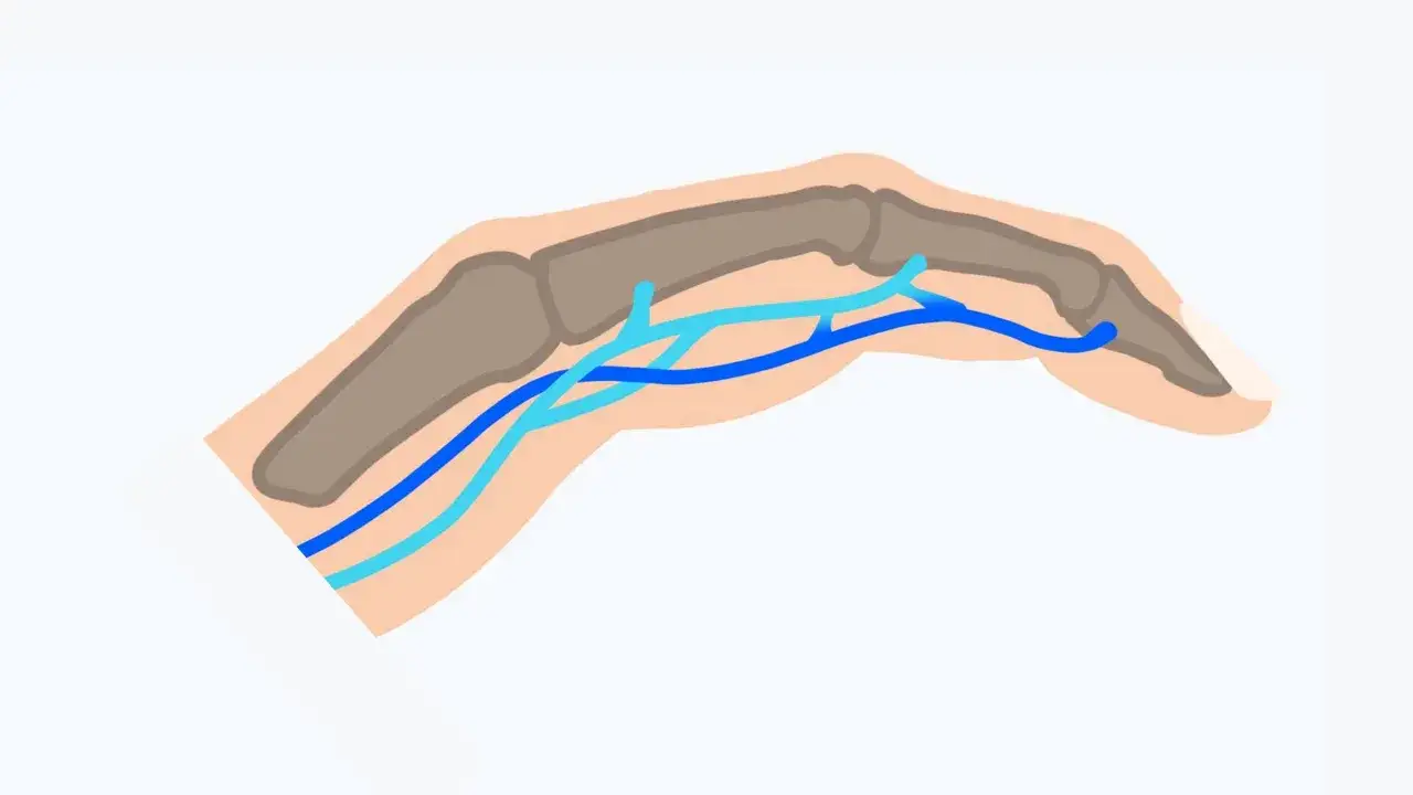Schematische Darstellung eines Fingers mit Knochen und Blutgefäßen. Mögliche Ursache für Finger schmerzen beim beugen.