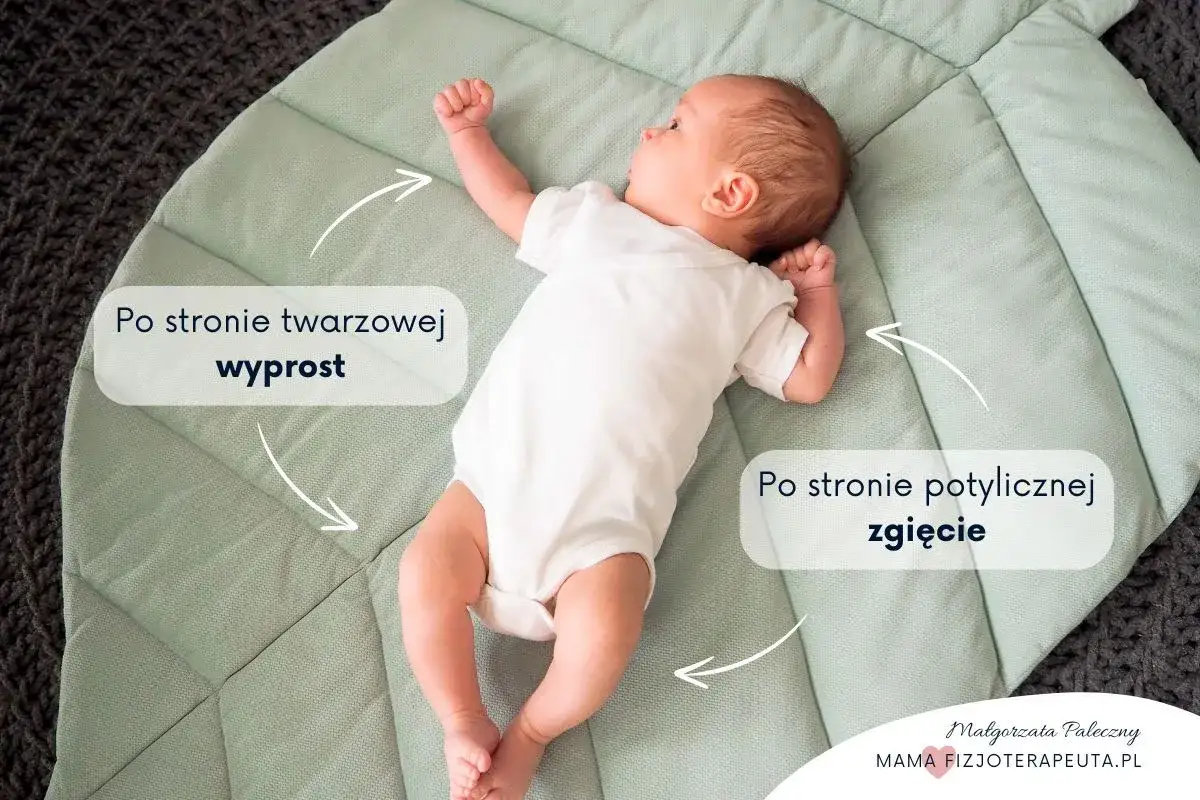 Dziecko śpi z głową w jedną stronę, z wyprostowanymi nóżkami po stronie twarzowej i zgiętymi po potylicznej.