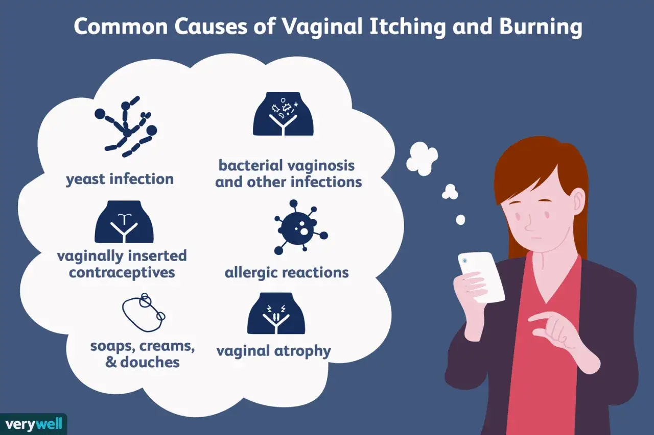 Illustrazione sulle cause del prurito intimo senza perdite: infezioni, contraccettivi, allergie, prodotti per l'igiene e atrofia.